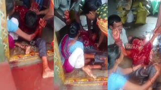 Phone explosion destroyed teens face.