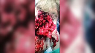 A compilation of gore.