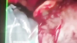 attack at Cartago country hotel