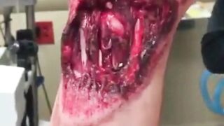 medical compilation