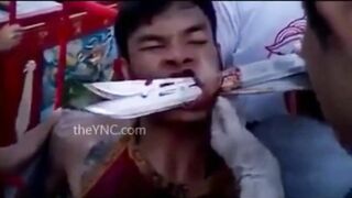 medical compilation