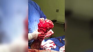 medical compilation