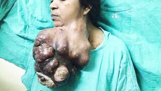 medical compilation