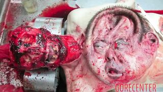 medical compilation
