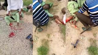Foot missing motorcycle accident