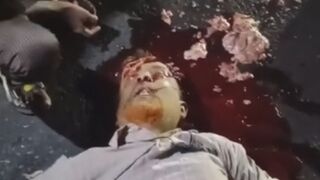 He Lost His Helmet, Brain And Life