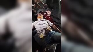 He Lost His Helmet, Brain And Life