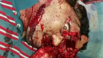 Gore Compilation #50