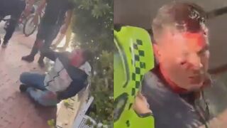 Two Thieves Face Street Justice In Colombia