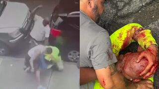 Man Stabs His EX-Girlfriend, Brutalized By Locals In New York