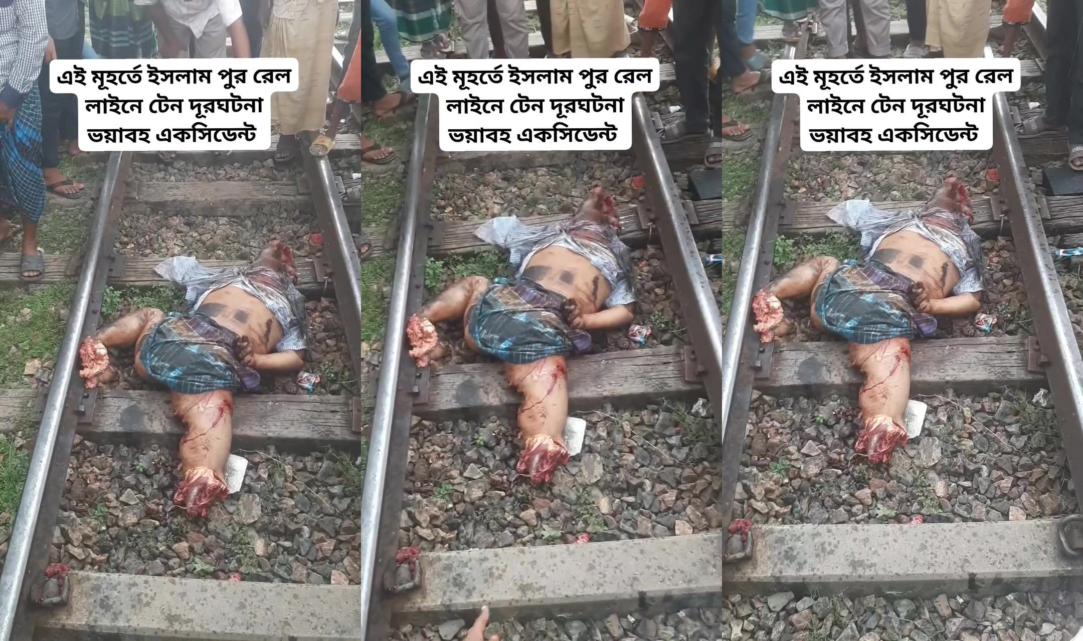 Train accident has man unrecognizable