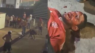 They Love This Game: Football Fan Savagely Beaten By Rivals