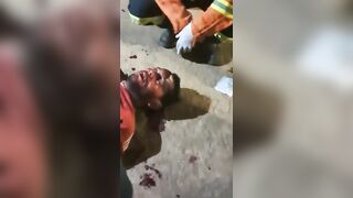 They Love This Game: Football Fan Savagely Beaten By Rivals