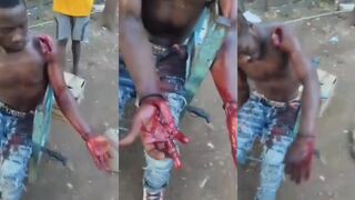 Machete Attack Survivor Takes it Like A Man