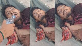 Man In Shock After Losing Arm In Traffic Accident