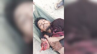 Man In Shock After Losing Arm In Traffic Accident