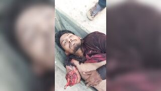 Man In Shock After Losing Arm In Traffic Accident
