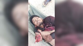 Man In Shock After Losing Arm In Traffic Accident