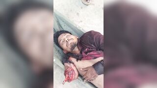 Man In Shock After Losing Arm In Traffic Accident