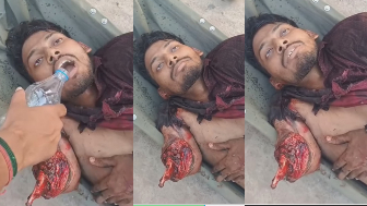 Man In Shock After Losing Arm In Traffic Accident
