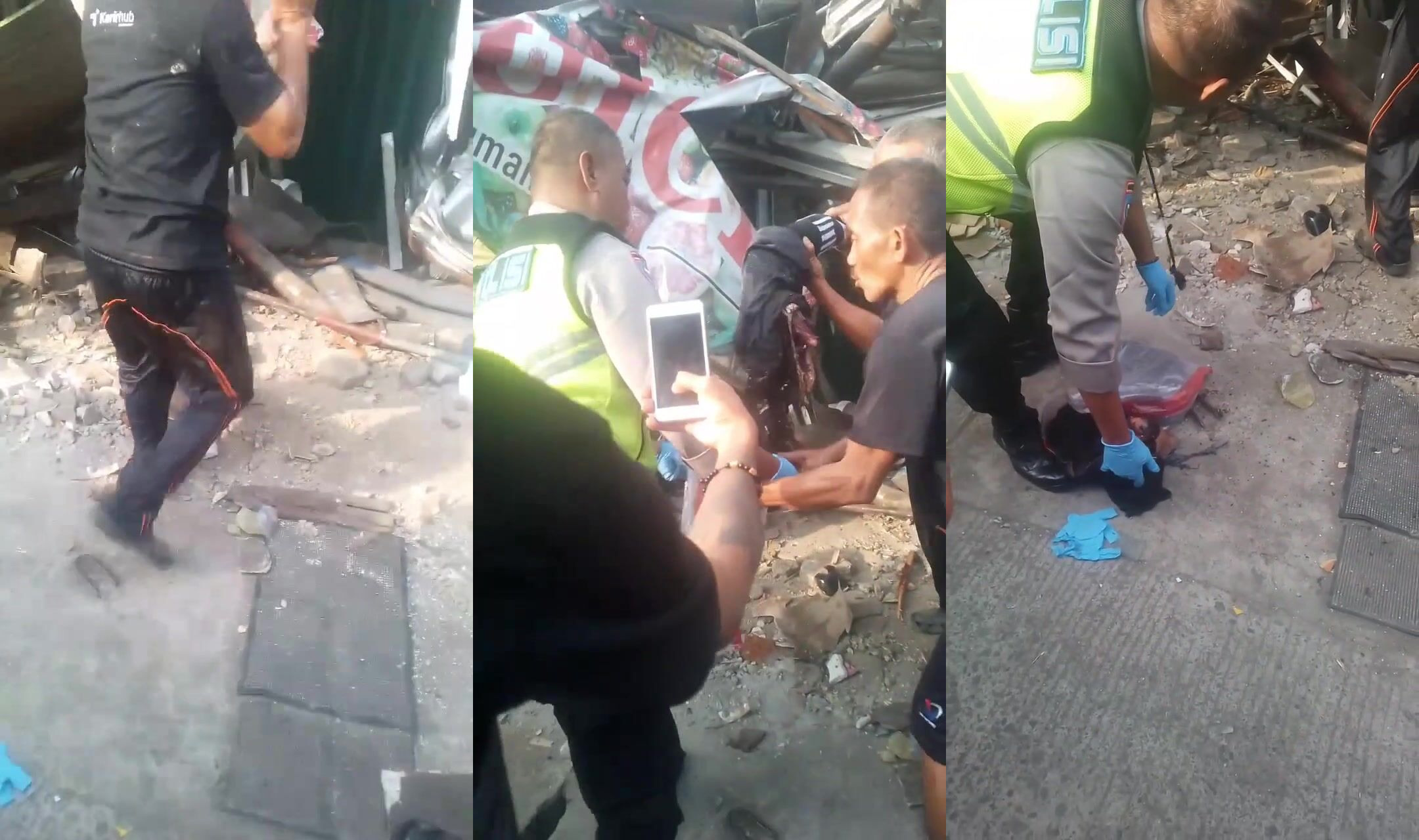 Leg severed in Malaysian accident
