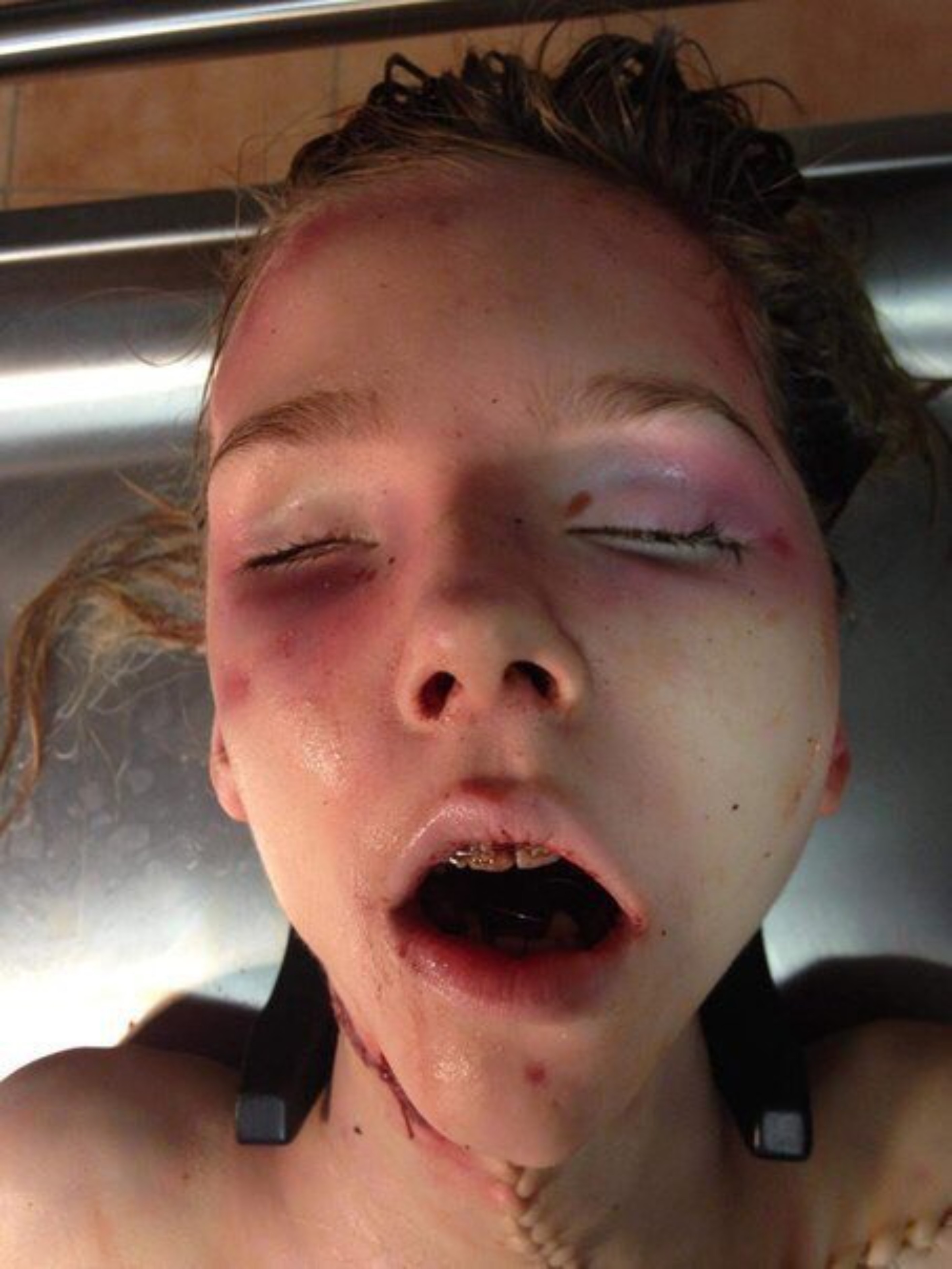 Young blonde female in morgue theYNC image picture