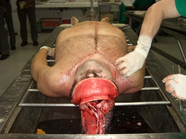 Theync autopsy fuck 