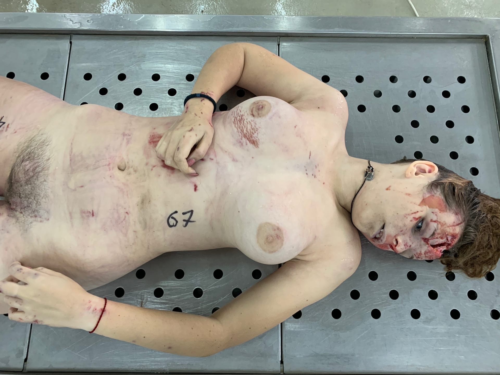 Dead young woman with cracked skull. | theYNC