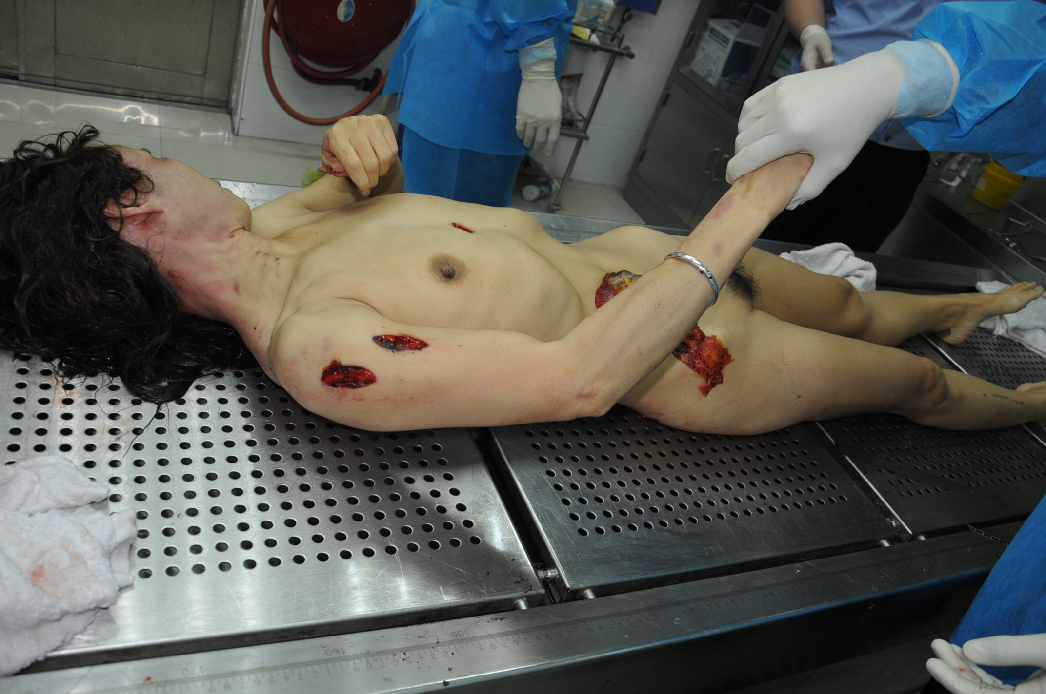 Theync autopsy fuck Zhou Jie was stabbed to death | theYNC