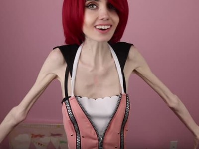 Eugenia Cooney anorexic 