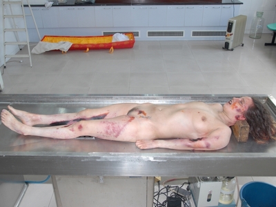 Bald Woman Butchered In The Morgue