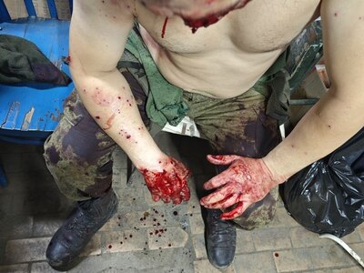 Russian Soldier Injured