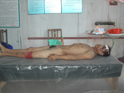 autopsy nude man 