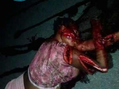 prostitute dead after brutal machete attack