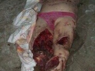 Ukrainian woman was hit by mortar