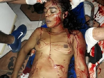 Topless Cute Brazilian young woman killed 