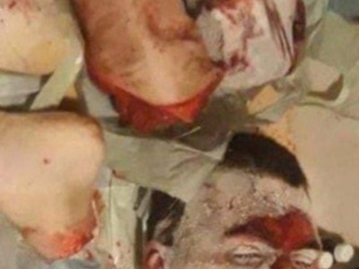 Ukrainian rapperâ€™s wife chopped up dead husbandâ€™s corpse 