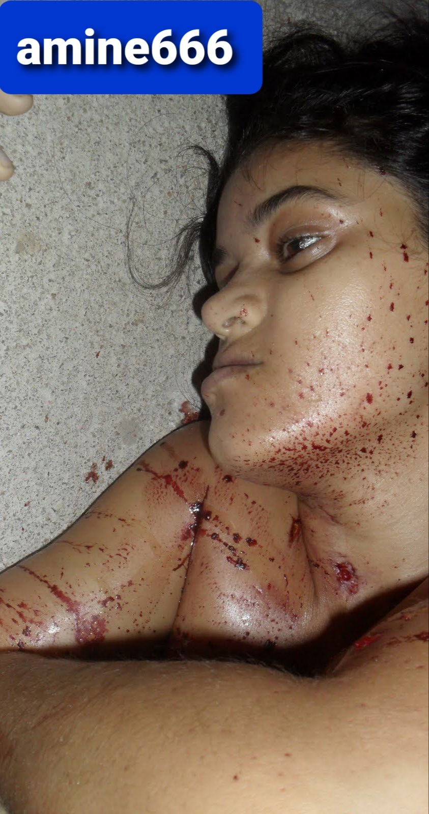 AMINE666  NAKEDdead girl naked amine666 Young women killed by ex boyfriend. | theYNC