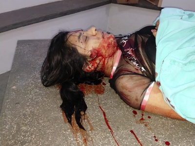 Girl Takes a Fatal Round During Shootout, Brazil.