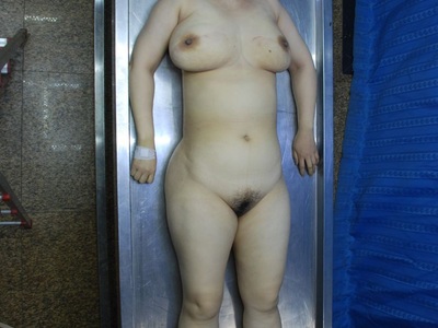 400px x 300px - Chubby Chinese dead woman laying nude on the autopsy table | theYNC