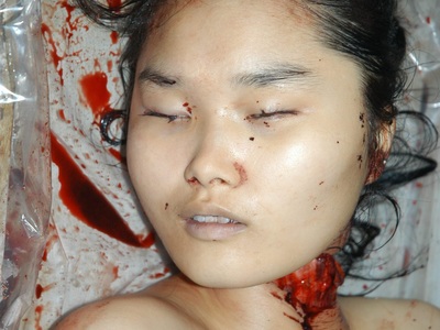 Autopsy of Chinese girl killed by cutting her throat