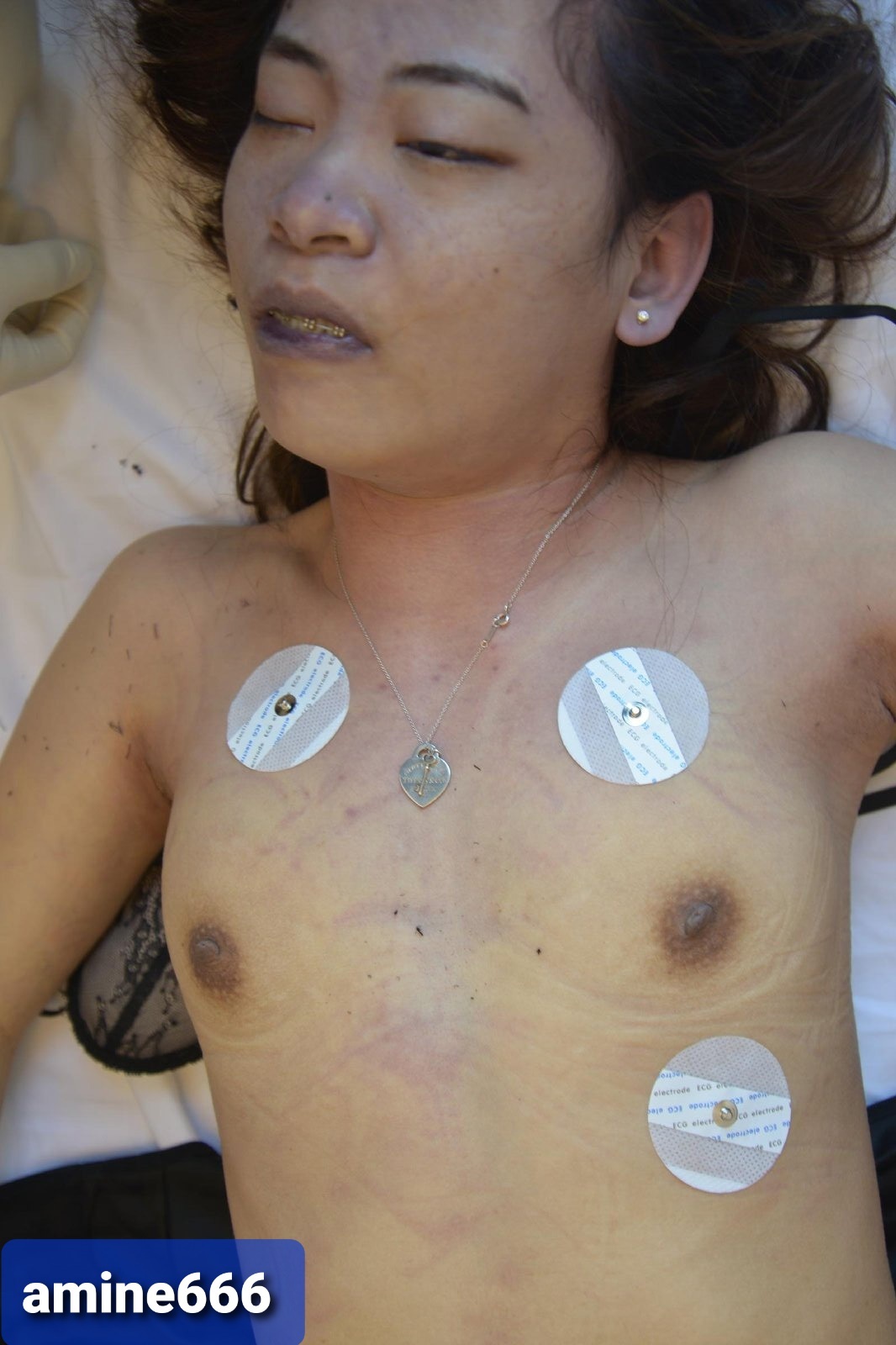 Examination corps of dead Chinese woman killed in hotel room theYNC pic