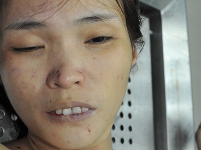 Examination of Chinese woman dead corps ho was raped ghen stabbed