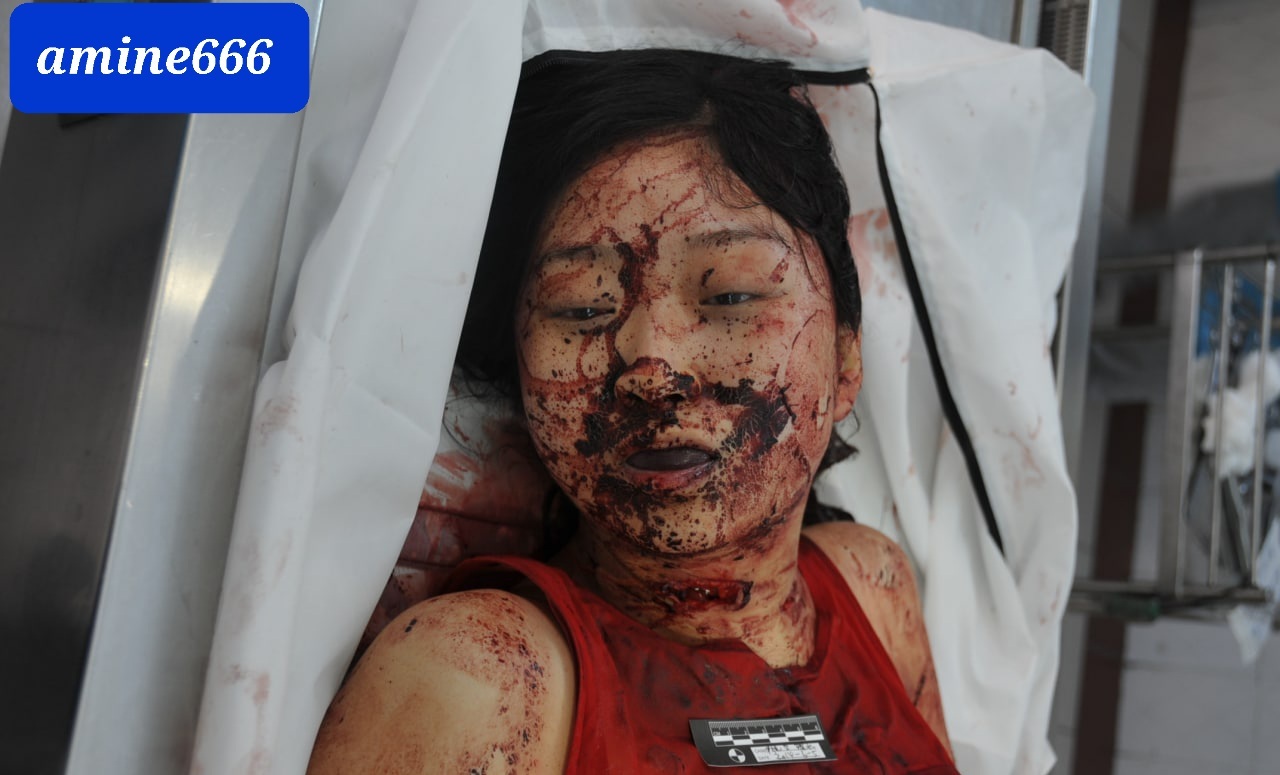 Theync autopsy fuck CHINESE FEMALE AUTOPSY] EXAMINATION CORPS OF MURDERED WOMAN | theYNC
