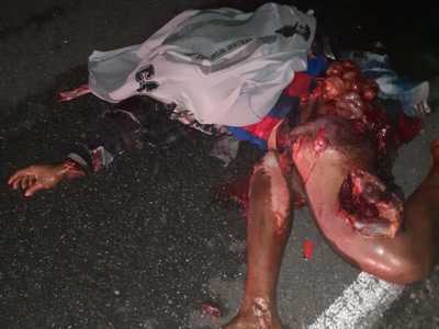 Brutal accident man totally shattered (photos) 