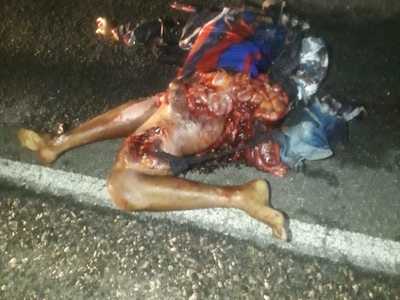 Brutal accident man totally shattered (photos) 