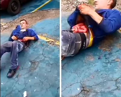 Man Fell on his Beer Bottle...Guts Exposed 