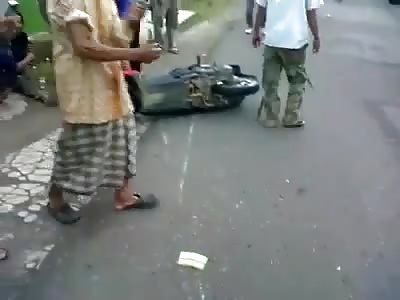 Skull smashed in accident 