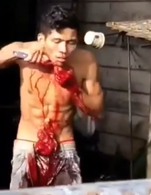Psycho Slits Own Throat And Bleeds To Death In Public