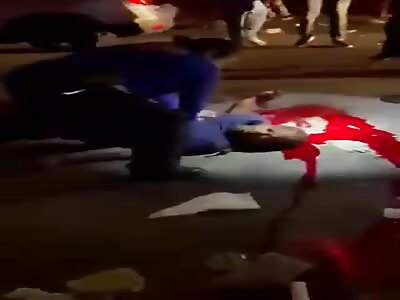 Man Shot In The Head At Brooklyn Block Party